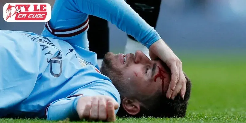 Bão Chấn Thương Ở Man City: Ai Sẽ Gánh Trách Nhiệm Trước Brentford?